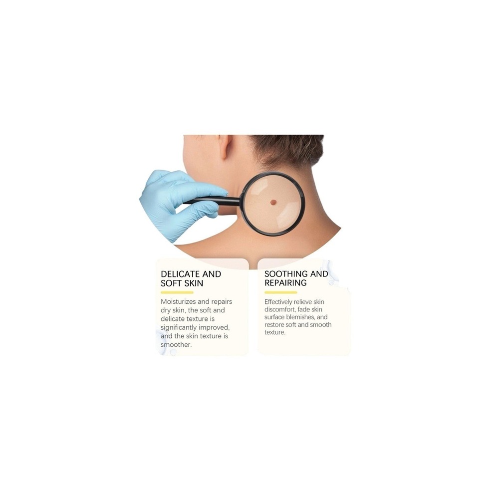 Bee Venom Skin Restoration Cream, Professional Bee Venom Skin Treatment Cream - Picture 6 of 9